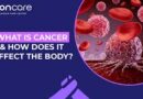 Ubushakashatsi: Kuki ubu bwoko 11 bwa Cancer burimo kwiyongera mu rubyiruko?